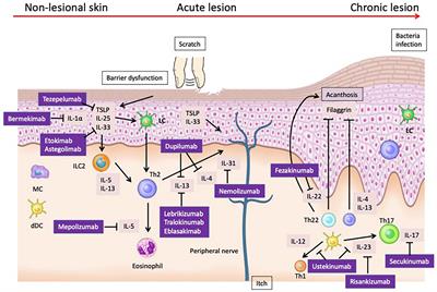 Interplay of cytokines in the pathophysiology of atopic dermatitis: insights from Murin models and human